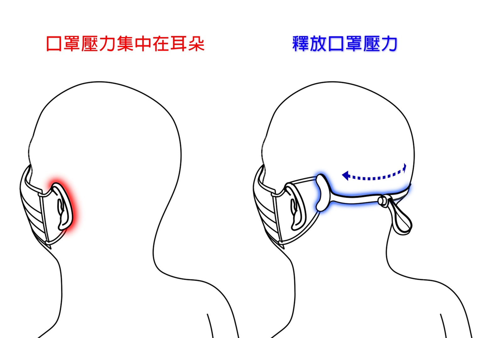 戴口罩耳朵減壓、口罩減壓帶、口罩耳朵減壓